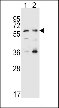 SLC22A4 Antibody (C-term) (Cat. #AP5986b) western blot analysis in Hela(lane 1),K562(lane 2) cell line lysates (35ug/lane).This demonstrates the SLC22A4 antibody detected the SLC22A4 protein (arrow).
