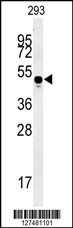 MYLK4 Antibody (C-term) (Cat. #AP5978b) western blot analysis in 293 cell line lysates (35ug/lane).This demonstrates the MYLK4 antibody detected the MYLK4 protein (arrow).
