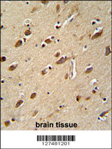 MYLK4 antibody (C-term) (Cat. #AP5978b) immunohistochemistry analysis in formalin fixed and paraffin embedded human brain tissue followed by peroxidase conjugation of the secondary antibody and DAB staining. This data demonstrates the use of the MYLK4 antibody (C-term) for immunohistochemistry. Clinical relevance has not been evaluated.