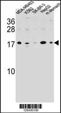 S100Z Antibody (N-term) (Cat. #AP10626a) western blot analysis in MDA-MB453,K562,SK-BR-3,HepG2 cell line and mouse stomach tissue lysates (35ug/lane).This demonstrates the S100Z antibody detected the S100Z protein (arrow).