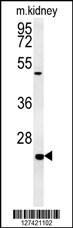 SHISA2 Antibody (C-term) (Cat. #AP5960b) western blot analysis in mouse kidney tissue lysates (15ug/lane).This demonstrates the SHISA2 antibody detected SHISA2 protein (arrow).