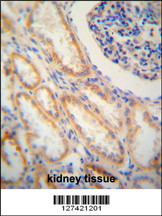 SHISA2 antibody (C-term) (Cat. #AP5960b) immunohistochemistry analysis in formalin fixed and paraffin embedded human kidney tissue followed by peroxidase conjugation of the secondary antibody and DAB staining. This data demonstrates the use of the SHISA2 antibody (C-term) for immunohistochemistry. Clinical relevance has not been evaluated.