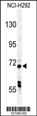 USP49 Antibody (N-term) (Cat. #AP5947a) western blot analysis in NCI-H292 cell line lysates (35ug/lane).This demonstrates the USP49 antibody detected the USP49 protein (arrow).