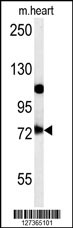 USP49 Antibody (N-term) (Cat. #AP5947a) western blot analysis in mouse heart tissue lysates (15ug/lane).This demonstrates the USP49 antibody detected USP49 protein (arrow).