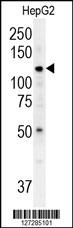 ATP13A3 Antibody (N-term) (Cat. #AP5938a) western blot analysis in HepG2 cell line lysates (35ug/lane).This demonstrates the ATP13A3 antibody detected the ATP13A3 protein (arrow).