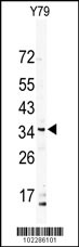 Western blot analysis of DSCR3 Antibody (N-term) (Cat.#AP6319a) in Y79 cell line lysates (35ug/lane). DSCR3 (arrow) was detected using the purified Pab.