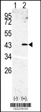 Western blot analysis of SPPL3(arrow) using rabbit polyclonal SPPL3 Antibody (N-term) (Cat.#AP6313a). 293 cell lysates (2 ug/lane) either nontransfected (Lane 1) or transiently transfected with the SPPL3 gene (Lane 2) (Origene Technologies).