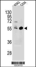 TEX9 Antibody (N-term) (Cat. #AP10612a) western blot analysis in K562,CEM cell line lysates (35ug/lane).This demonstrates the TEX9 antibody detected the TEX9 protein (arrow).