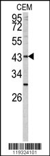 Western blot analysis of FUT1 antibody (Center) (Cat. #AP6573c) in CEM cell line lysates (35ug/lane). FUT1 (arrow) was detected using the purified Pab.