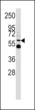 Western blot analysis of UDB17 antibody (Center) (Cat.# AP6505c) in Y79 cell line lysates (35ug/lane). UDB17 (arrow) was detected using the purified Pab.