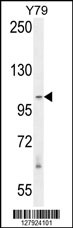 RASAL3 Antibody (C-term) (Cat. #AP10598b) western blot analysis in Y79 cell line lysates (35ug/lane).This demonstrates the RASAL3 antibody detected the RASAL3 protein (arrow).