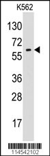 Western blot analysis of anti-GPC6 Pab (Cat.#AP6374a) in K562 cell line lysates (35ug/lane). GPC6(arrow) was detected using the purified Pab.