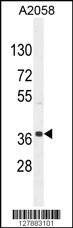 NKAPL Antibody (C-term) (Cat. #AP10590b) western blot analysis in A2058 cell line lysates (35ug/lane).This demonstrates the NKAPL antibody detected the NKAPL protein (arrow).