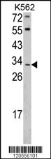 Western blot analysis of ITM2A Antibody (N-term) (Cat. #AP6765a) in K562 cell line lysates (35ug/lane). ITM2A (arrow) was detected using the purified Pab.