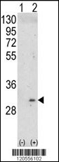 Western blot analysis of ITM2A (arrow) using rabbit polyclonal ITM2A Antibody (N-term) (Cat. #AP6765a). 293 cell lysates (2 ug/lane) either nontransfected (Lane 1) or transiently transfected with the ITM2A gene (Lane 2) .