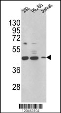 Western blot analysis of HSD17B7 Antibody (N-term) (Cat. #AP6760a) in 293,HL-60,Jurkat cell line lysates (35ug/lane). HSD17B7 (arrow) was detected using the purified Pab.(2ug/ml)