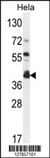 DEGS2 Antibody (C-term) (Cat. #AP10582b) western blot analysis in Hela cell line lysates (35ug/lane).This demonstrates the DEGS2 antibody detected the DEGS2 protein (arrow).
