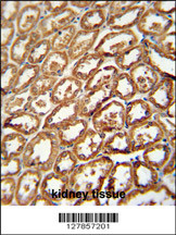 DEGS2 antibody (C-term) (Cat. #AP10582b) immunohistochemistry analysis in formalin fixed and paraffin embedded human kidney tissue followed by peroxidase conjugation of the secondary antibody and DAB staining. This data demonstrates the use of the DEGS2 antibody (C-term) for immunohistochemistry. Clinical relevance has not been evaluated.