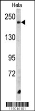 Western blot analysis of CPD Antibody (C-term) (Cat. #AP6725b) in Hela cell line lysates (35ug/lane). CPD (arrow) was detected using the purified Pab.
