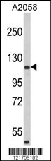Western blot analysis of HMHA1 Antibody (Center) (Cat. #AP6985c) in A2058 cell line lysates (35ug/lane). HMHA1 (arrow) was detected using the purified Pab.