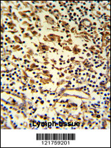 Formalin-fixed and paraffin-embedded human lymph reacted with HMHA1 Antibody (Center), which was peroxidase-conjugated to the secondary antibody, followed by DAB staining. This data demonstrates the use of this antibody for immunohistochemistry; clinical relevance has not been evaluated.
