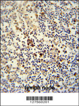 LY6G6C antibody (C-term) (Cat. #AP10539b) immunohistochemistry analysis in formalin fixed and paraffin embedded human lymph node followed by peroxidase conjugation of the secondary antibody and DAB staining. This data demonstrates the use of the LY6G6C antibody (C-term) for immunohistochemistry. Clinical relevance has not been evaluated.
