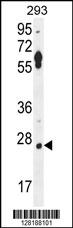 LRRC57 Antibody (C-term) (Cat. #AP10537b) western blot analysis in 293 cell line lysates (35ug/lane).This demonstrates the LRRC57 antibody detected the LRRC57 protein (arrow).