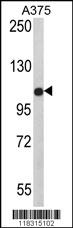 Western blot analysis of PALA Antibody (N-term) (Cat. #AP6845a) in A375 cell line lysates (35ug/lane). PALA (arrow) was detected using the purified Pab.