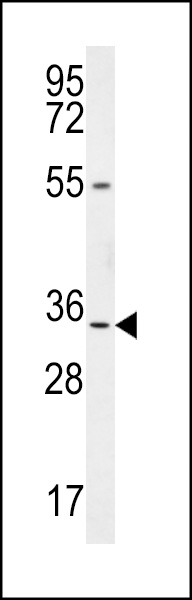 LRC18 Antibody (C-term) (Cat. #AP10529b) western blot analysis in mouse bladder tissue lysates (35ug/lane).This demonstrates the LRC18 antibody detected the LRC18 protein (arrow).