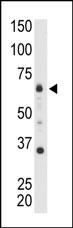 The anti-MTMR8 C-term Pab (Cat. #AP6808a) is used in Western blot to detect MTMR8 in mouse heart tissue lysate.