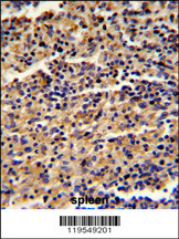 Formalin-fixed and paraffin-embedded human spleen reacted with ALKBH8 Antibody (C-term), which was peroxidase-conjugated to the secondary antibody, followed by DAB staining. This data demonstrates the use of this antibody for immunohistochemistry; clinical relevance has not been evaluated.