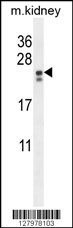 PIGX Antibody (N-term) (Cat. #AP10521a) western blot analysis in mouse kidney tissue lysates (35ug/lane).This demonstrates the PIGX antibody detected the PIGX protein (arrow).