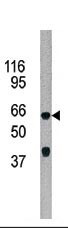 The anti-ADCK5 Pab (Cat. #AP7108b) is used in Western blot to detect ADCK5 in 293 cell line lysate.