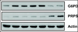 Role of PPP during MSC transformation. (A) G6PD activity decreased during MSC transformation (∗, P=0.0132; t test). Western blot confirms the down-regulation of G6PD and the up-regulation of PRPS at the late stages of transformation.
