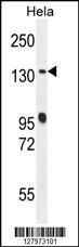 DEN5A Antibody (Center) (Cat. #AP10513c) western blot analysis in Hela cell line lysates (35ug/lane).This demonstrates the DEN5A antibody detected the DEN5A protein (arrow).