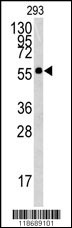 Western blot analysis of BTBD1 antibody (Center) (Cat.#AP7323c) in 293 cell line lysates (35ug/lane). BTBD1 (arrow) was detected using the purified Pab.