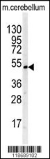 Western blot analysis of BTBD1 antibody (Center) (Cat.#AP7323c) in mouse cerebellum tissue lysates (35ug/lane). BTBD1 (arrow) was detected using the purified Pab.