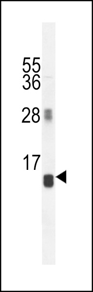 AVPI1 Antibody (N-term) (Cat. #AP10506a) western blot analysis in MCF-7 cell line lysates (35ug/lane).This demonstrates the AVPI1 antibody detected the AVPI1 protein (arrow).