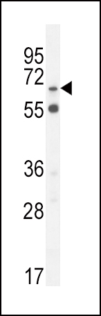 S6A12 Antibody (N-term) (Cat. #AP10503a) western blot analysis in MDA-MB231 cell line lysates (35ug/lane).This demonstrates the S6A12 antibody detected the S6A12 protein (arrow).