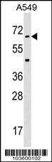 STK35 Antibody (C255) (Cat. #AP7243c) western blot analysis in A549 cell line lysates (35ug/lane).This demonstrates the STK35 antibody detected the STK35 protein (arrow).