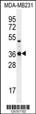 TPSD1 Antibody (C-term) (Cat. #AP10500b) western blot analysis in MDA-MB231 cell line lysates (35ug/lane).This demonstrates the TPSD1 antibody detected the TPSD1 protein (arrow).