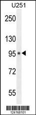 MICALL1 Antibody (C-term) (Cat. #AP10498a) western blot analysis in U251 cell line lysates (35ug/lane).This demonstrates the MICALL1 antibody detected the LACRT protein (arrow).