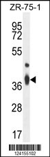 TMBIM4 Antibody (N-term) (Cat. #AP10496a) western blot analysis in ZR-75-1 cell line lysates (35ug/lane).This demonstrates the TMBIM4 antibody detected the TMBIM4 protein (arrow).