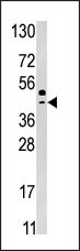 Western blot analysis of anti-SEPSH2 Pab(Cat. #AP7188b) in HepG2 cell line lysate (35ug/lane). SEPSH2(arrow) was detected using the purified Pab.