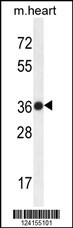 TMBIM4 Antibody (N-term) (Cat. #AP10496a) western blot analysis in mouse heart tissue lysates (35ug/lane).This demonstrates the TMBIM4 antibody detected the TMBIM4 protein (arrow).