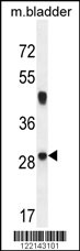 NCALD Antibody (C-term) (Cat. #AP10495b) western blot analysis in mouse bladder tissue lysates (35ug/lane).This demonstrates the NCALD antibody detected the NCALD protein (arrow).