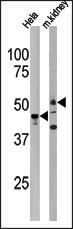 Western blot analysis of anti-PSKH1 Antibody (N-term H70) (Cat.#AP7179c) in Hela cell line lysate and mouse kidney tissue lysate (35ug/lane). PSKH1 (arrow) was detected using the purified Pab.