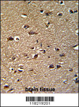 Formalin-fixed and paraffin-embedded human brain reacted with GCAT Antibody (Center), which was peroxidase-conjugated to the secondary antibody, followed by DAB staining. This data demonstrates the use of this antibody for immunohistochemistry; clinical relevance has not been evaluated.