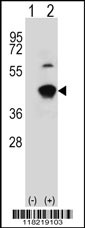 Western blot analysis of GCAT (arrow) using rabbit polyclonal GCAT Antibody (Center) (Cat.#AP7498c). 293 cell lysates (2 ug/lane) either nontransfected (Lane 1) or transiently transfected (Lane 2) with the GCAT gene.