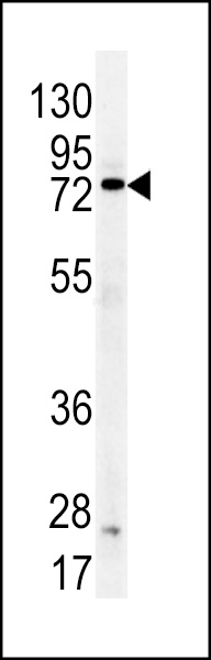 Western blot analysis of DDX53 antibody (C-term) (Cat.#AP7491b) in mouse kidney tissue lysates (35ug/lane). DDX53 (arrow) was detected using the purified Pab.